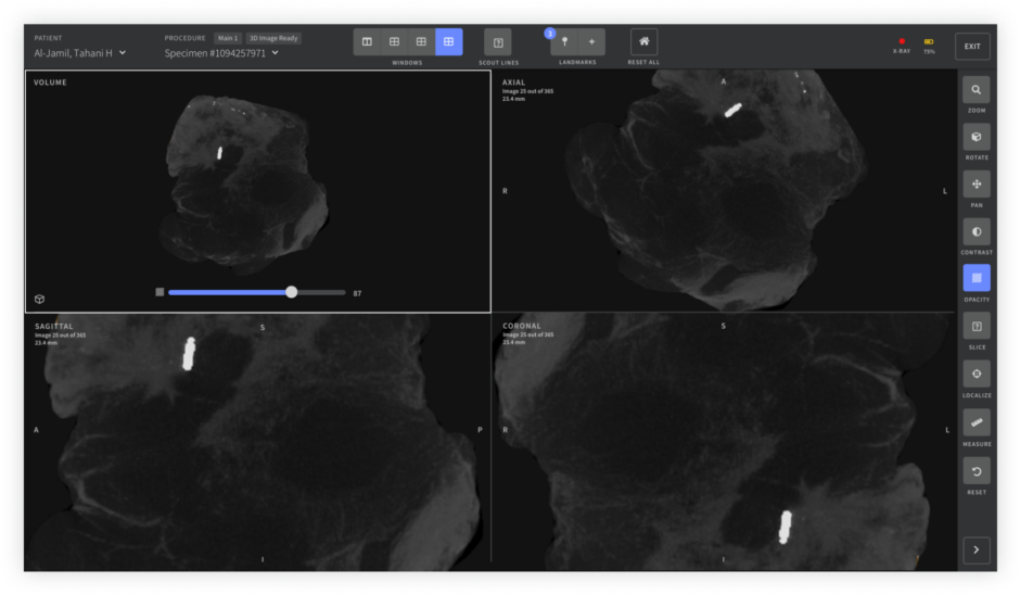 Clarix Imaging scanning feature that analyzes specimen like tumors
